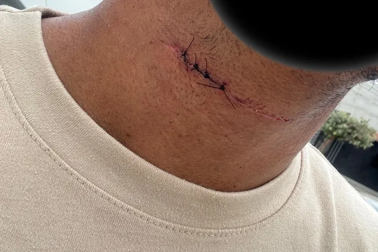 Foto: Lay Amorim/Achei Sudoeste 