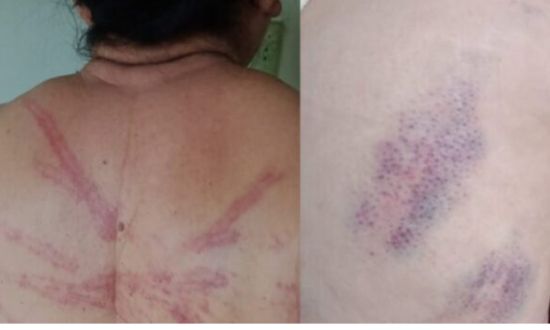 Idosa é tortura e agredida/Folha do Vale